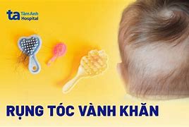 Rụng Tóc Ở Trẻ Sơ Sinh